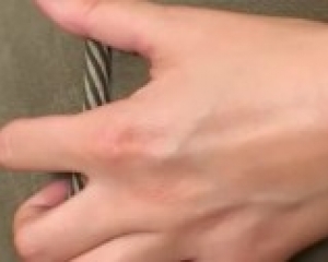 Mandy Bright punciját rendbe rakják